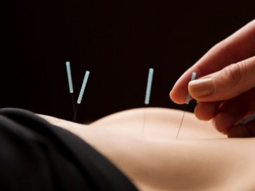The Science of Acupuncture