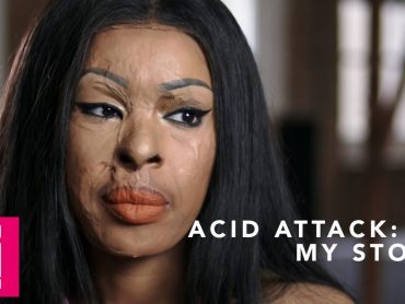 Acid Attack: My Story