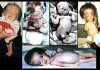 The Doctor, the Depleted Uranium, and the Dying Children